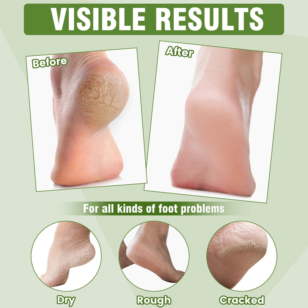 TEAWOO foot mask in use on feet offering quick hydration convenience