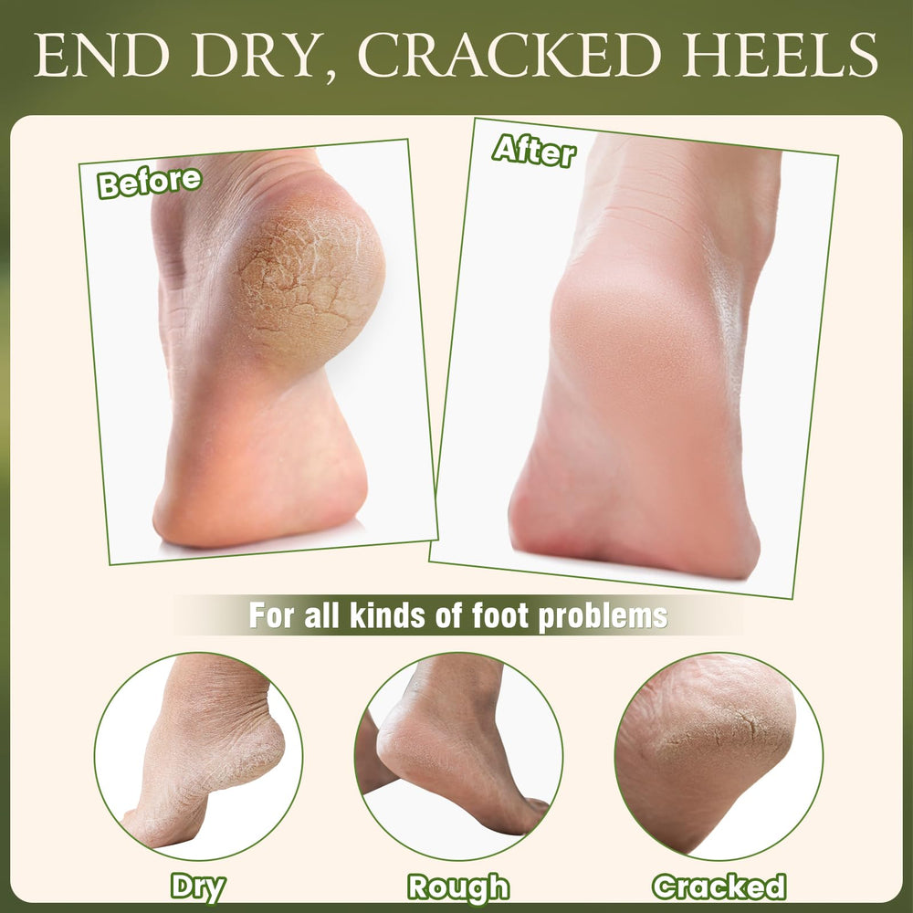 TEAWOO gel-lined heel socks pair laid flat to lock in moisture