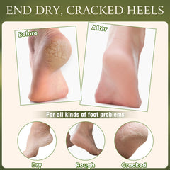 TEAWOO gel-lined heel socks pair laid flat to lock in moisture