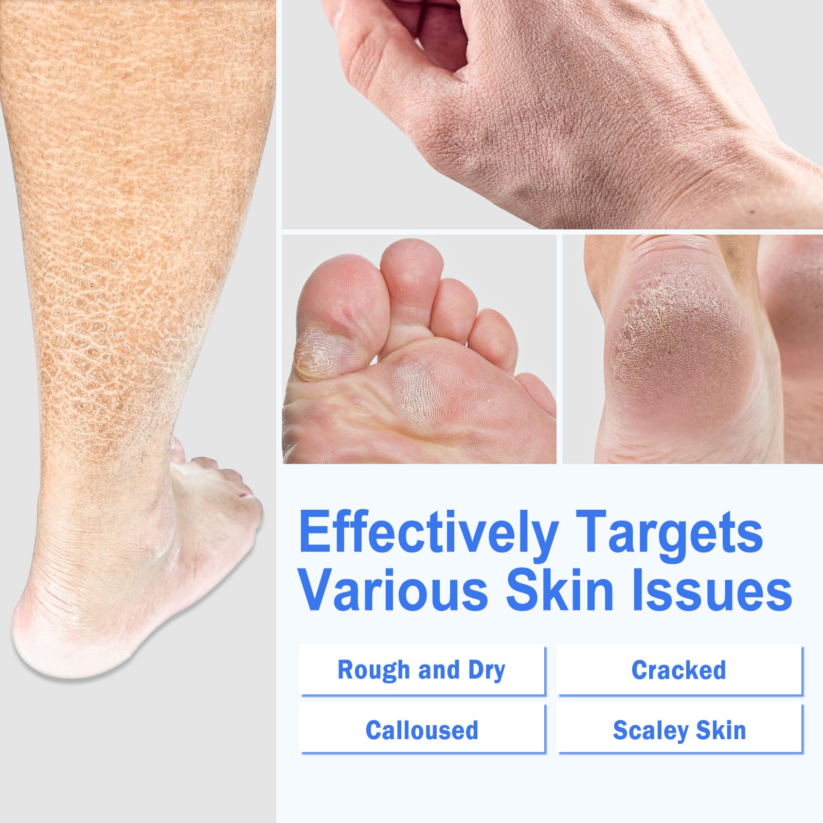 TEAWOO silicone socks pair demonstrating improved cream absorption and fit