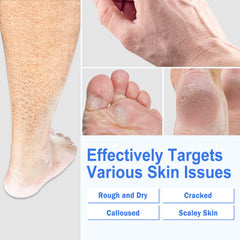 TEAWOO silicone socks pair demonstrating improved cream absorption and fit