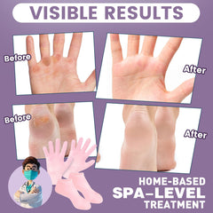 TEAWOO silicone socks worn on feet while relaxing, enabling hands-free moisturizing