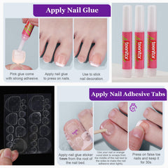 Teenitor tools and adhesives laid out showing glue, tabs, files for prep