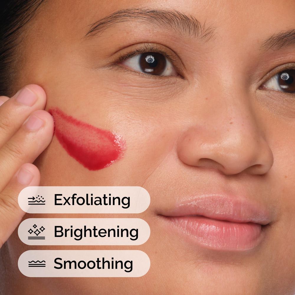 The Ordinary peeling solution application in use on cheek, shows short at‑home peel process and safety