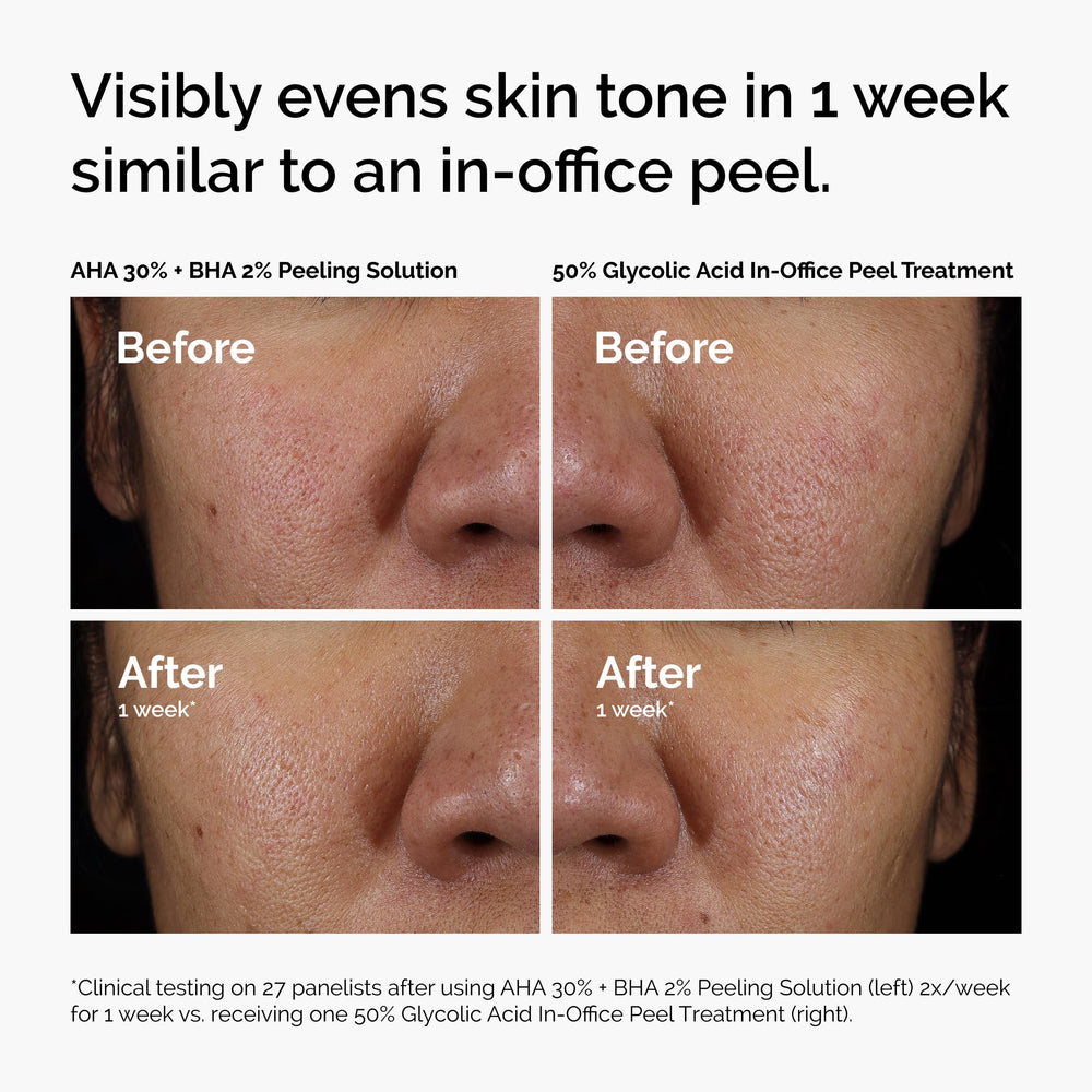 The Ordinary peeling solution ingredients label closeup, clarifies key actives and supportive hydration