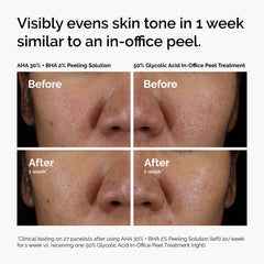 The Ordinary peeling solution ingredients label closeup, clarifies key actives and supportive hydration