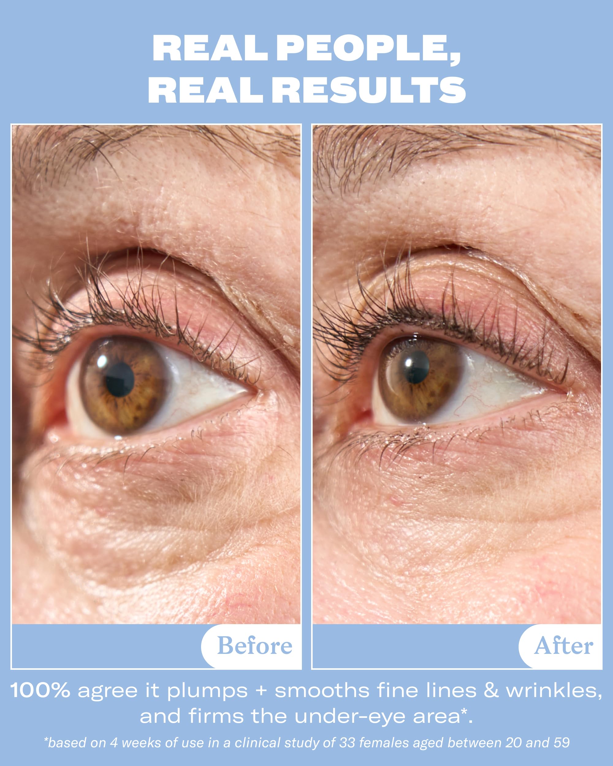 Then I Met You ceramic applicator close-up for cooling, mess-free eye application benefit