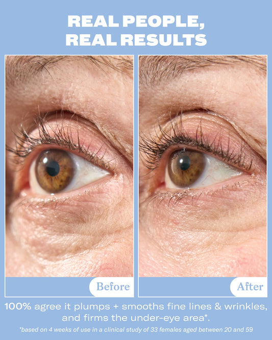 Then I Met You ceramic applicator close-up for cooling, mess-free eye application benefit