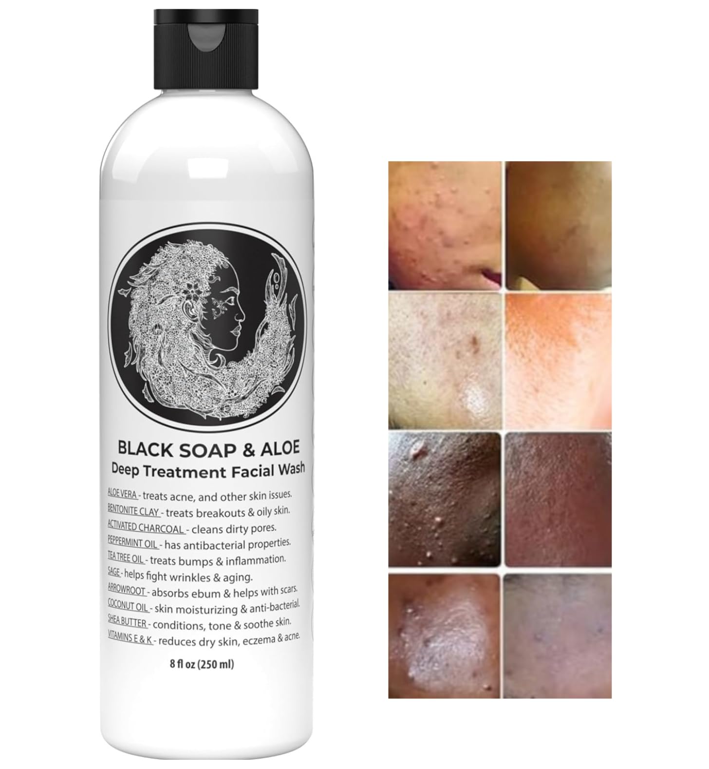This Soap Works front bottle showing label and calming design benefits clear skin