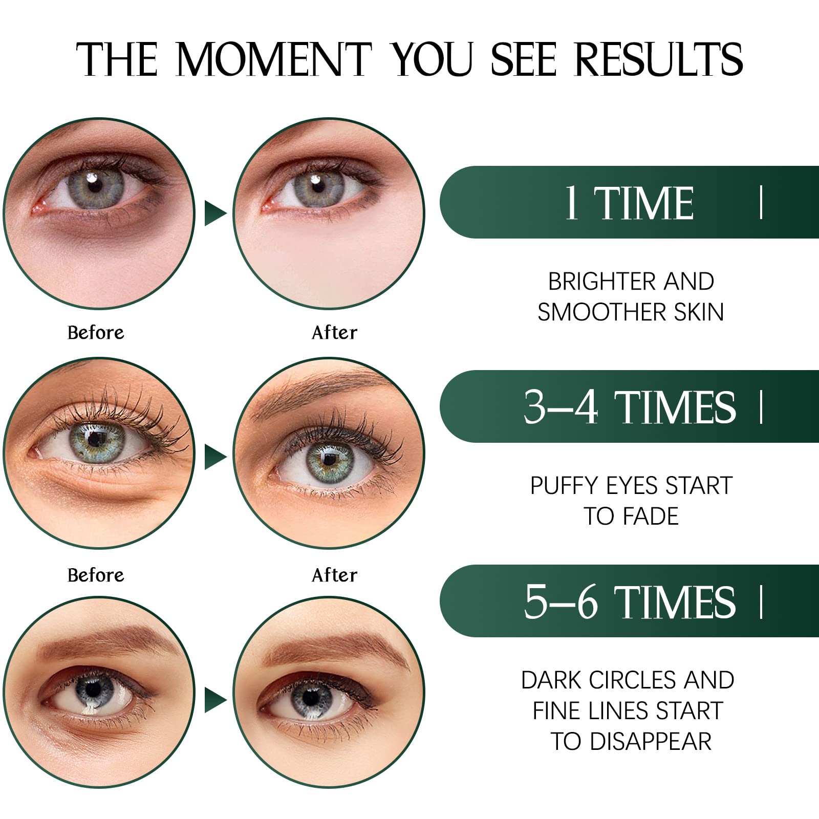 Tiepetly application in use under eye illustrating secure fit and instant cooling