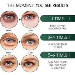Tiepetly application in use under eye illustrating secure fit and instant cooling