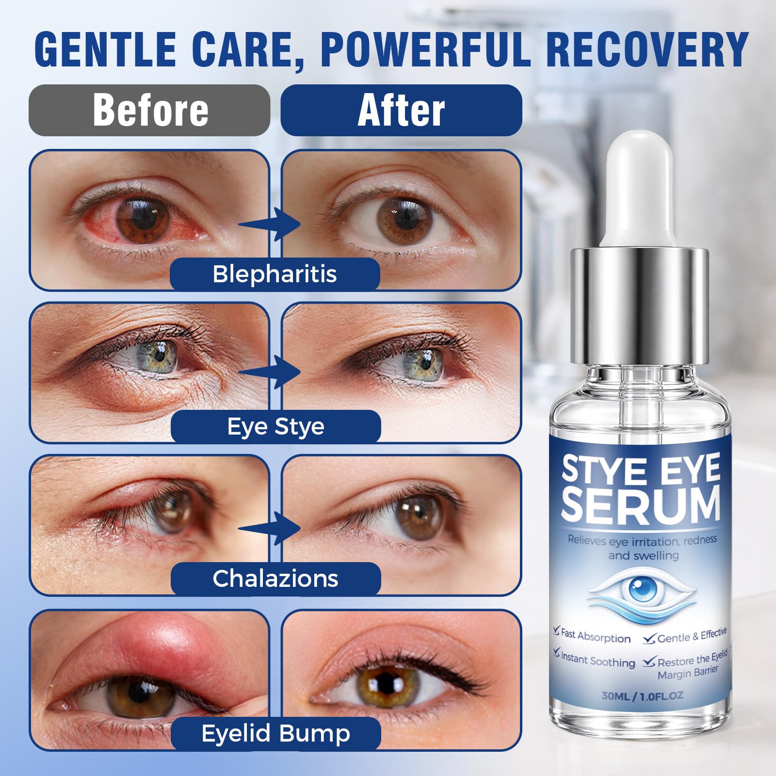 Tiepetly dropper application closeup demonstrating precise targeted dosing