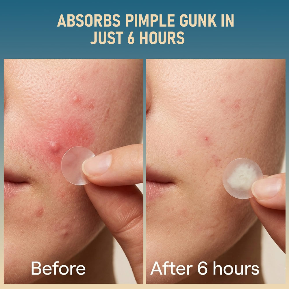 TKGOU invisible patch on cheek under light makeup for discreet blemish concealment