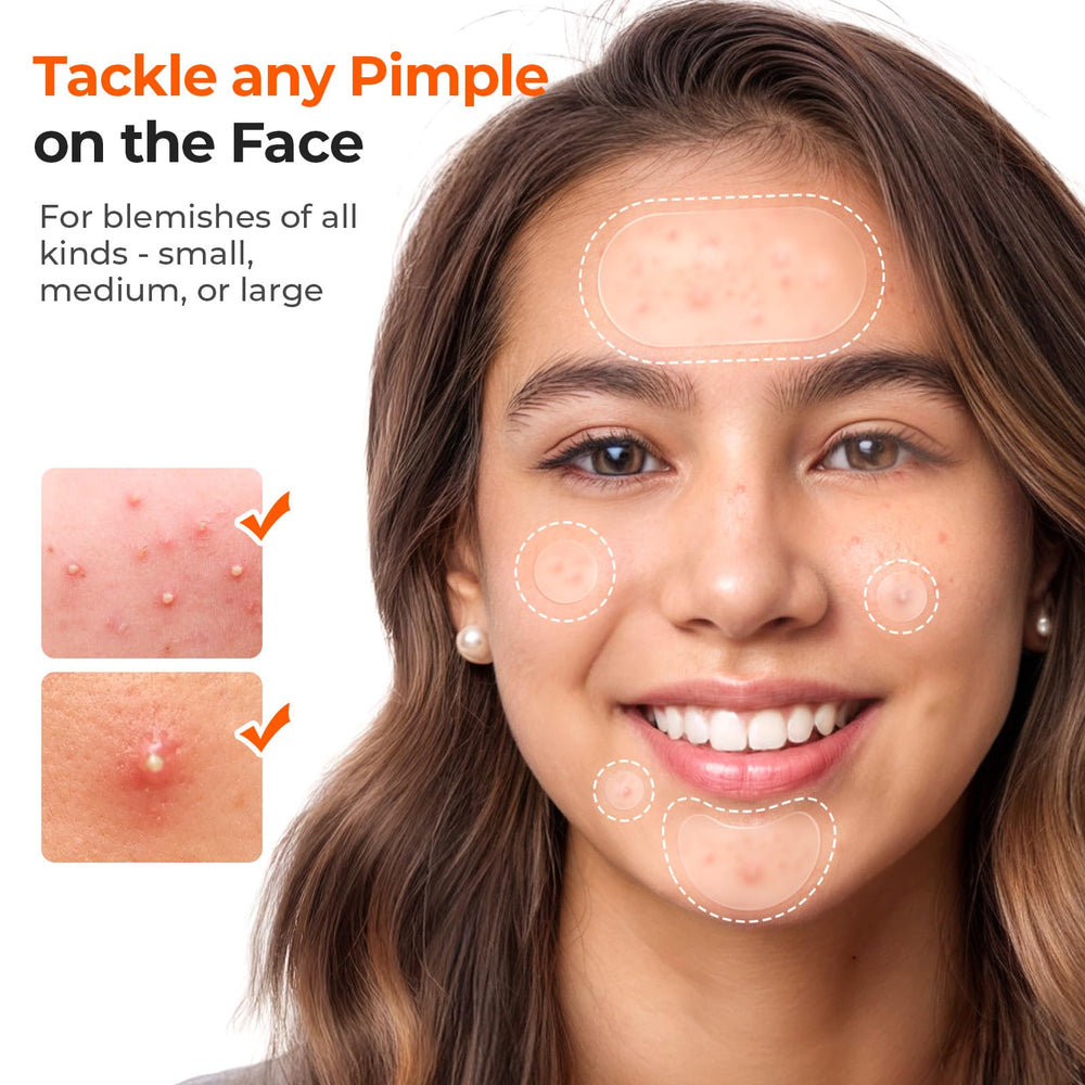 TKTK small 8mm and 12mm spot patches close-up for precise coverage