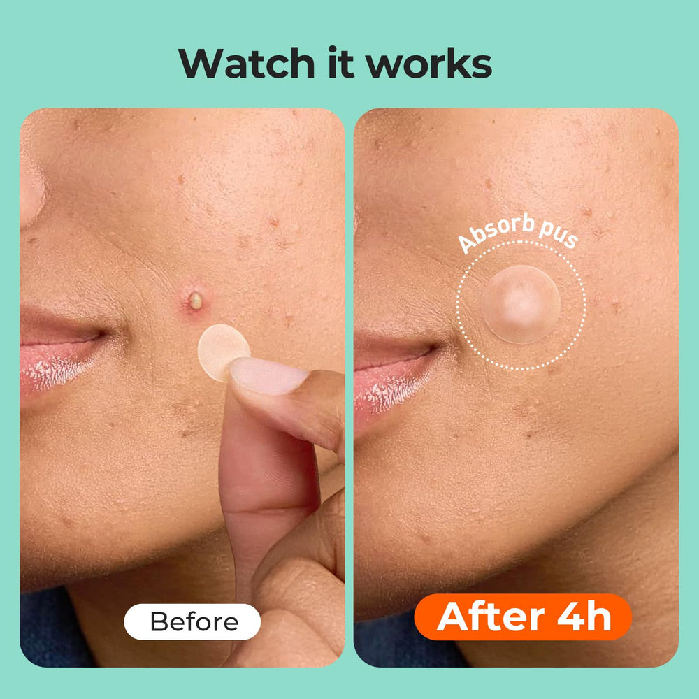 TKTK close-up hydrocolloid texture demonstrating absorbent, protective surface
