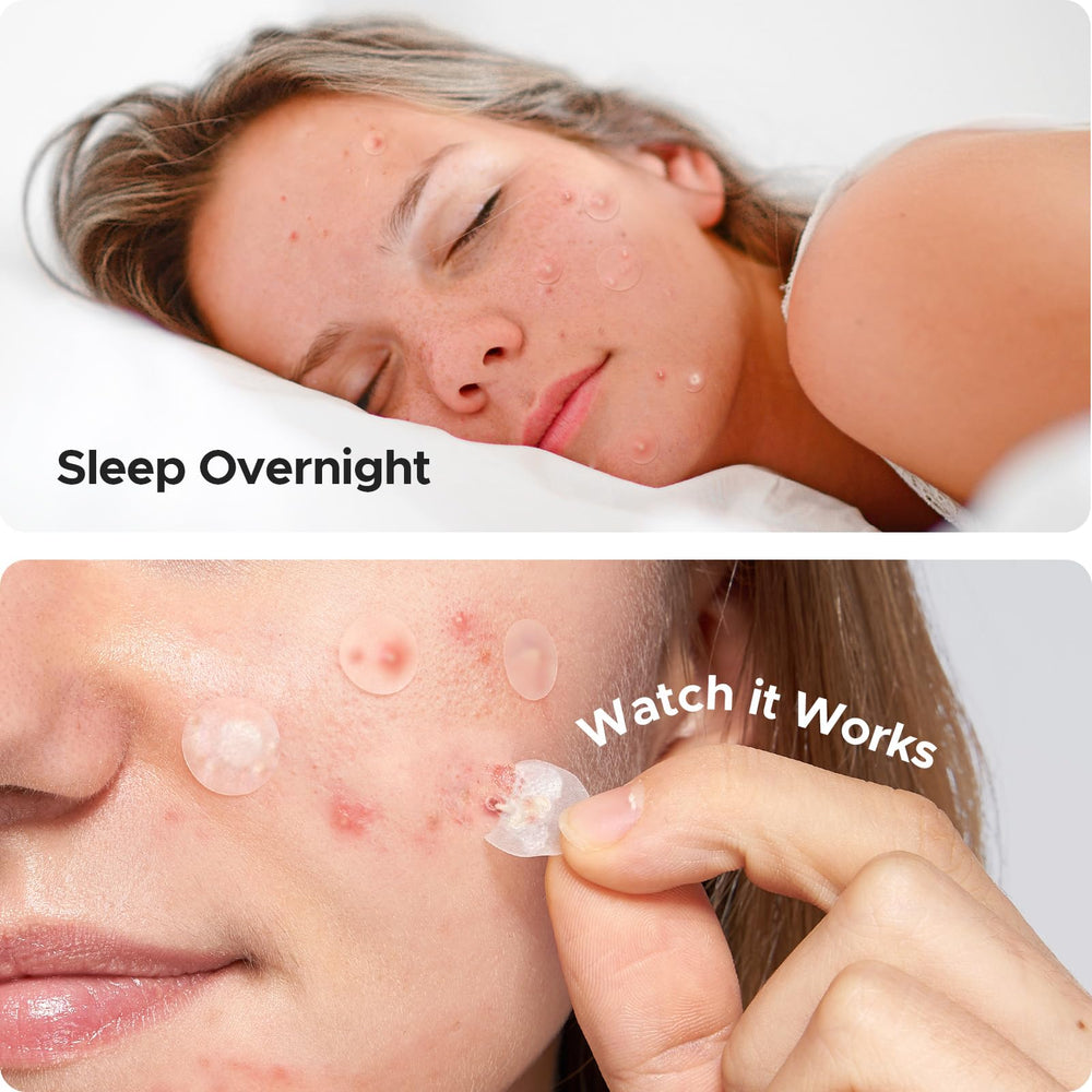 TKTK patch on jawline while sleeping showing overnight protection