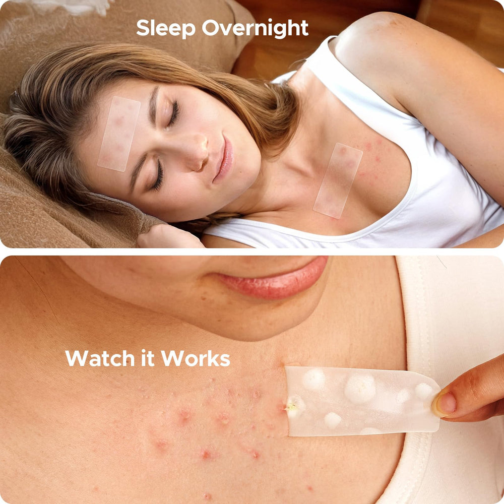 TKTK patch on forehead in use, discreet coverage and protection