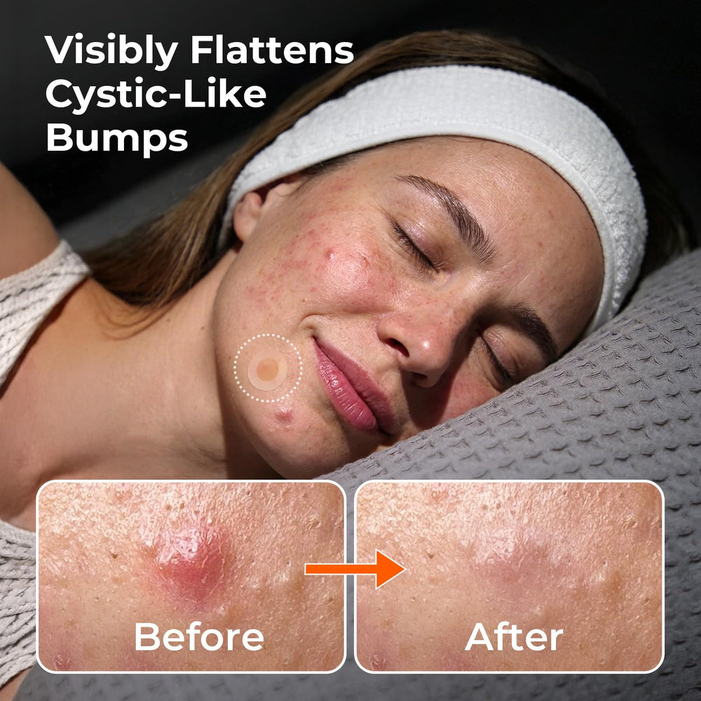 TKTK patch applied on cheek demonstrating discreet, protective spot coverage