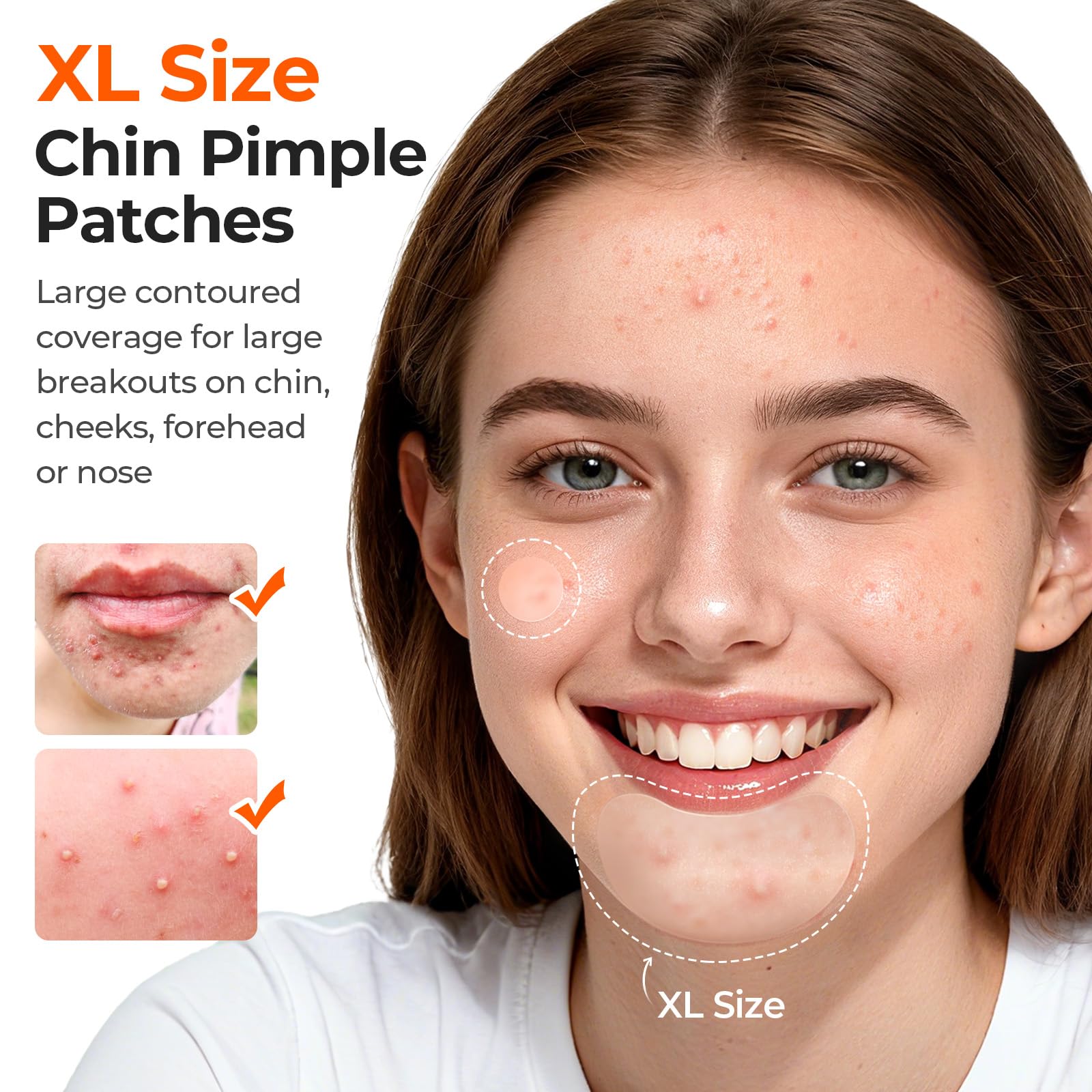 TKTK close-up of XL moon patch hugging chin contours for fuller coverage