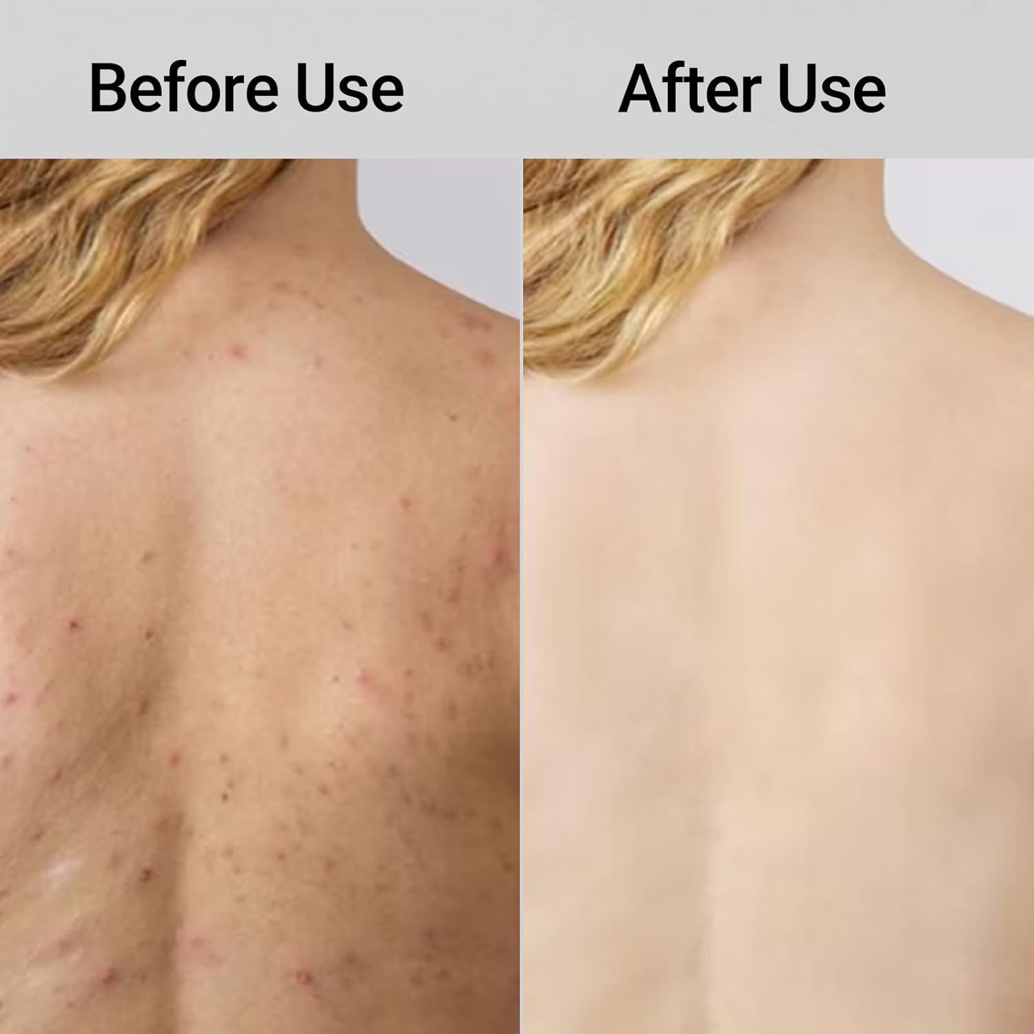 TLOPA Blissal two sides comparison showing soft and firm textures for tailored care