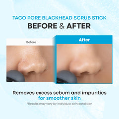 TONYMOLY applied to nose demonstrating targeted pore cleansing benefit