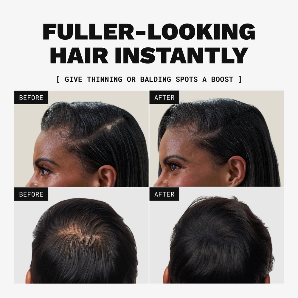 Hand applying Toppik fibers to thinning area for instant thicker hair appearance