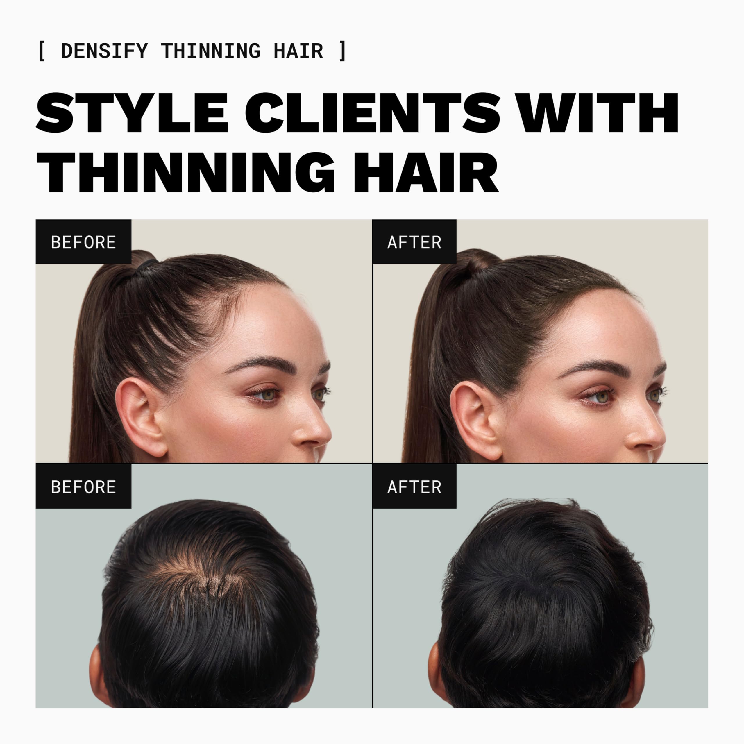 TOPPIK PRO being sprinkled onto a client scalp to conceal thinning quickly