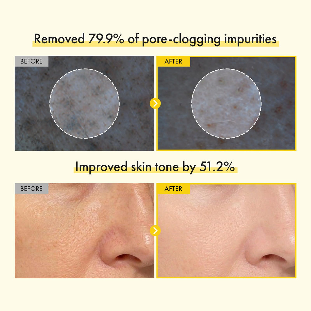 TOSOWOONG visible capsules in foam delivering active ingredients