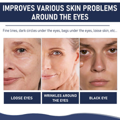 Traboto application under-eye demonstration illustrating easy targeted use