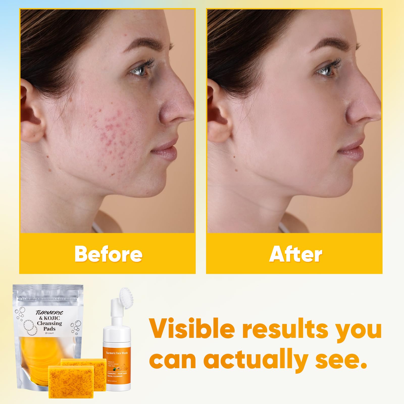 Treeroot cleansing mousse pump detail for easy foaming and control