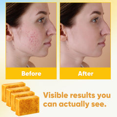 Treeroot ingredients display turmeric and kojic acid illustrating natural actives