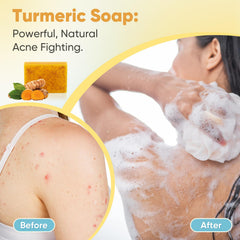 Treeroot ingredients display with turmeric and collagen showcasing natural active benefits