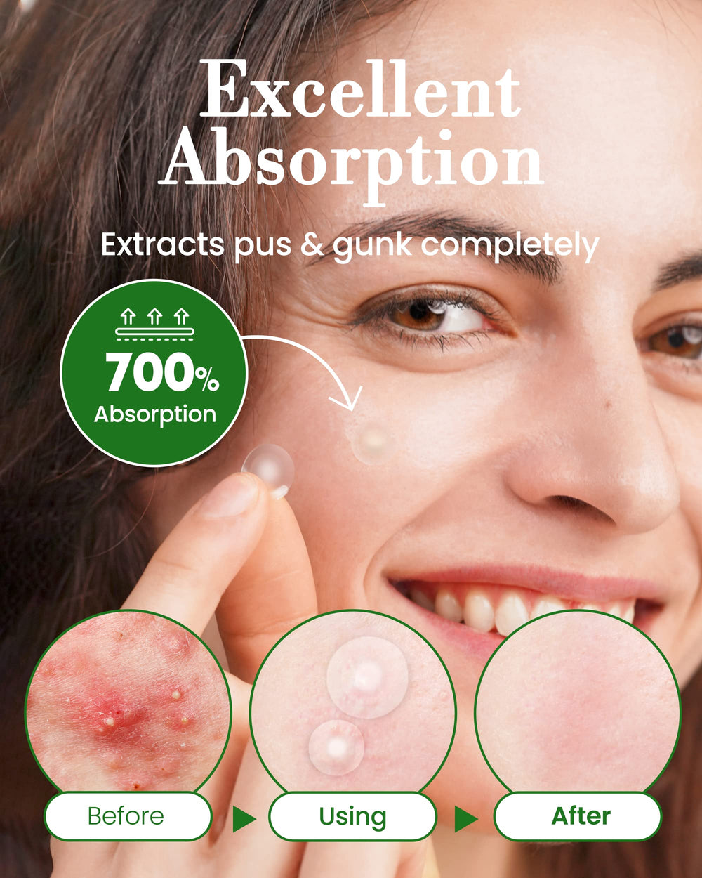 Troubless patch applied on skin protecting blemish with discreet coverage