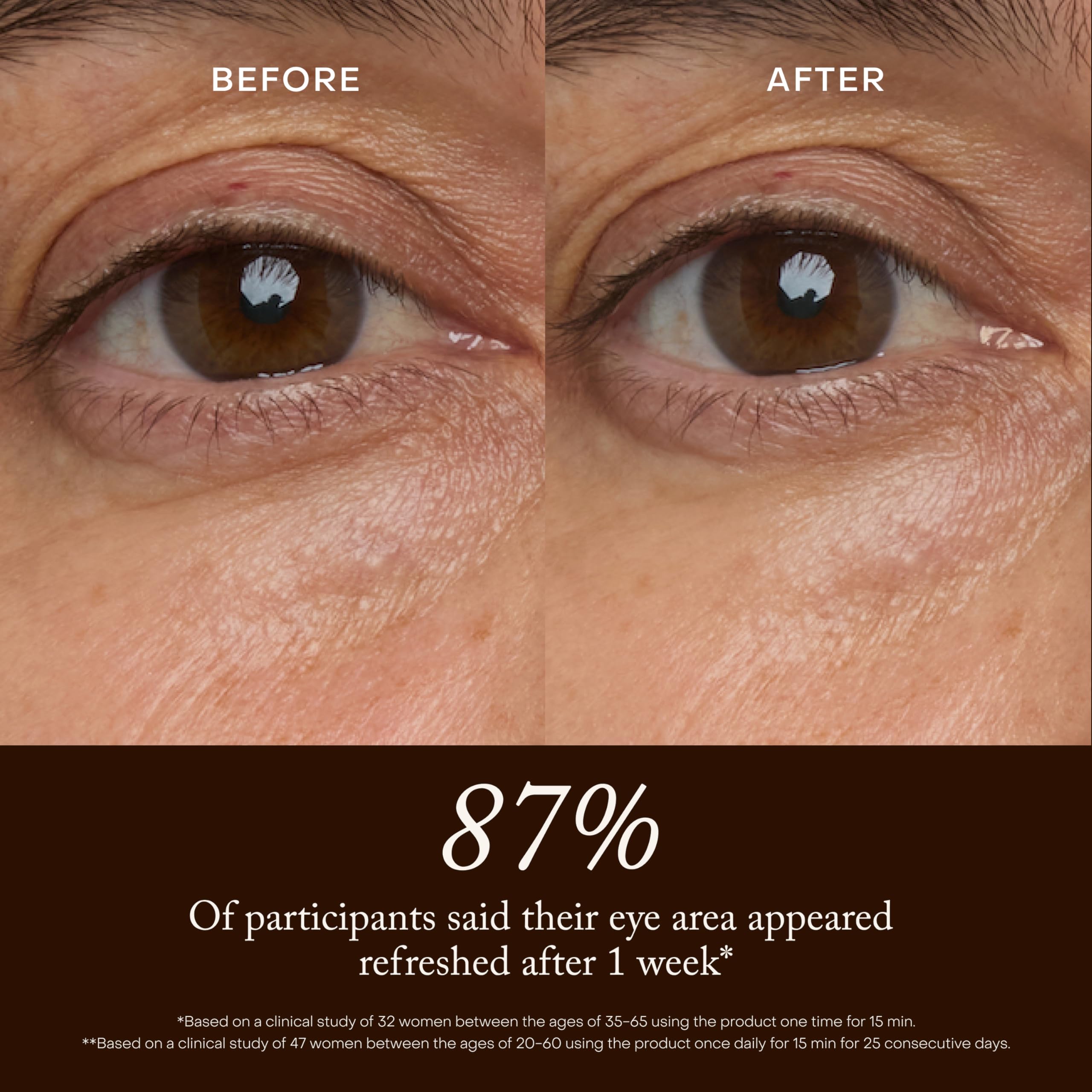 True Botanicals before and after under-eye appearance improvement