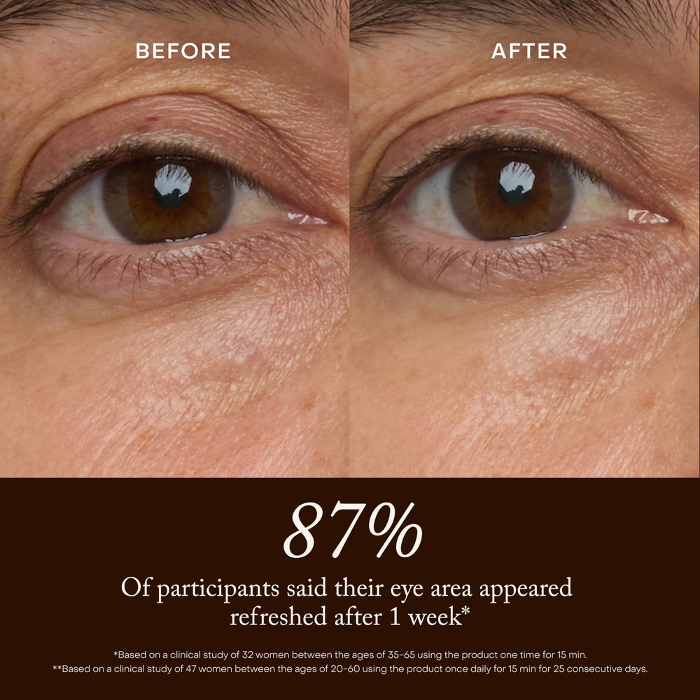 True Botanicals before and after under-eye appearance improvement