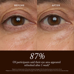 True Botanicals before and after under-eye appearance improvement