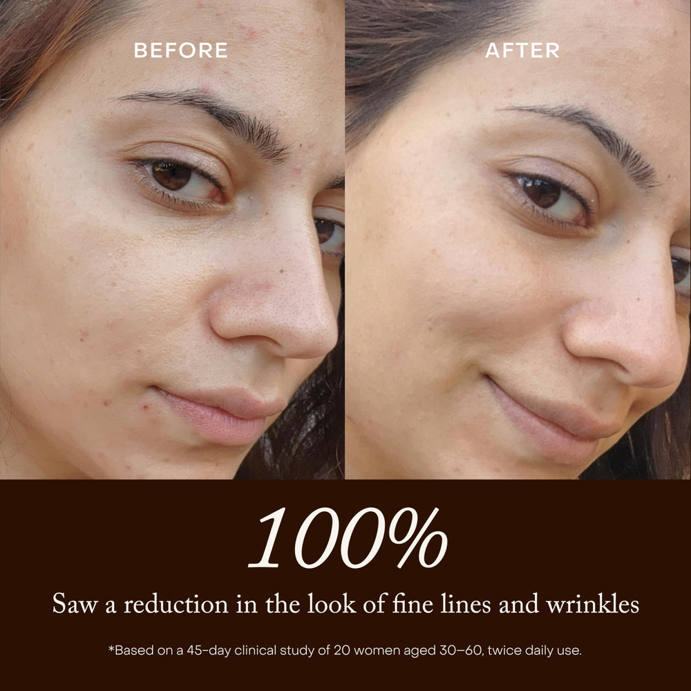True Botanicals rosehip and seed oils highlighting antioxidant-rich ingredients