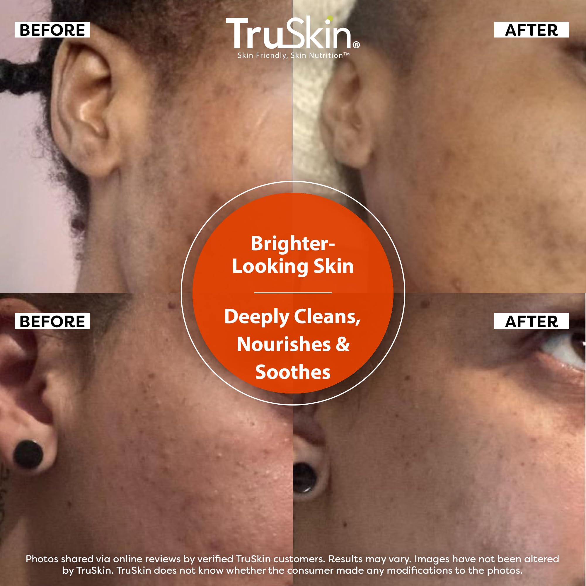 TruSkin aloe leaf and gel staged to show calming hydration benefits