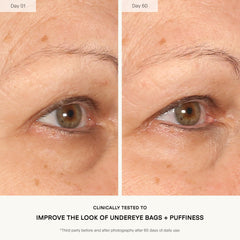 U Beauty applying concentrate with applicator for precise under-eye delivery