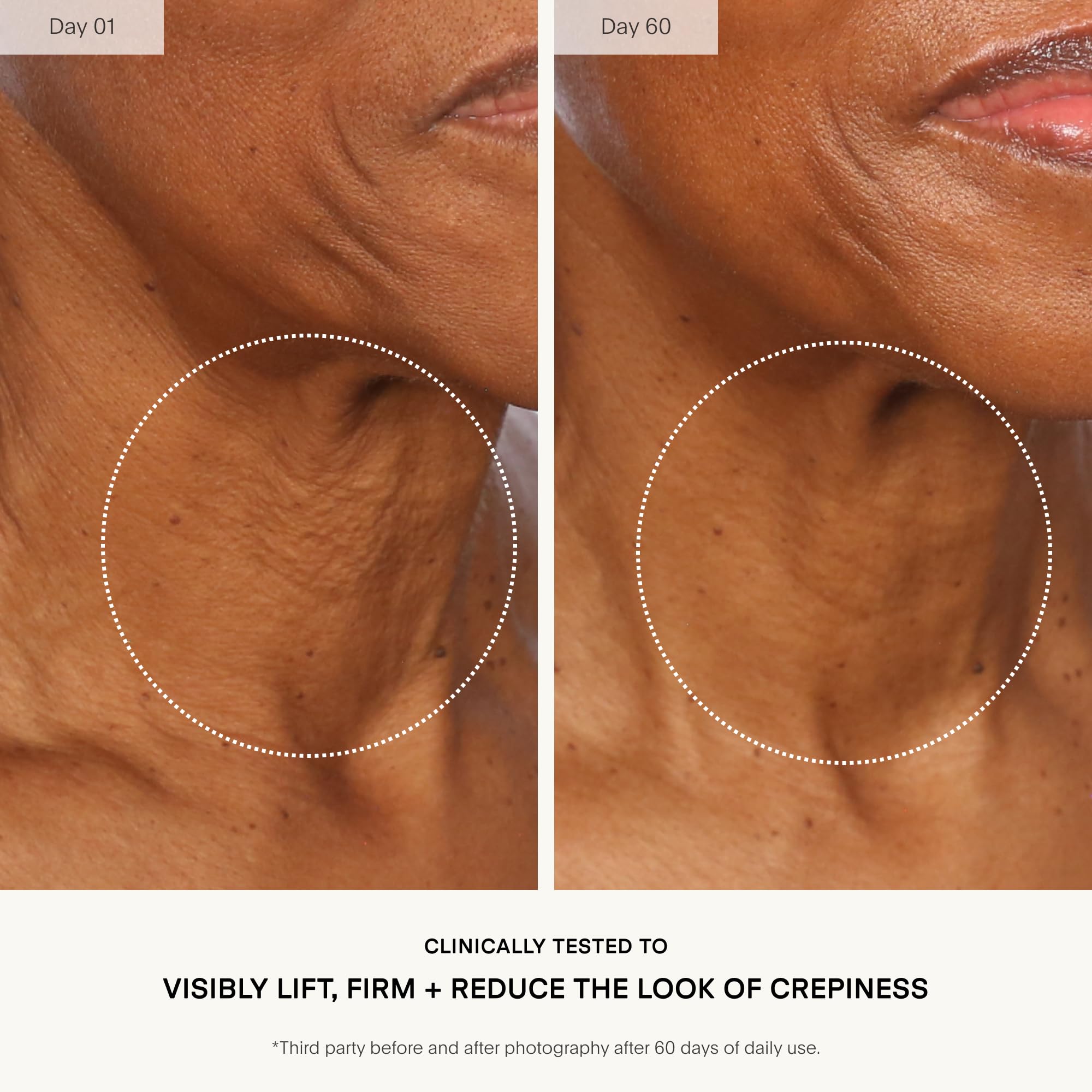 U Beauty application on neck demonstrating even coverage and visible smoothing benefit