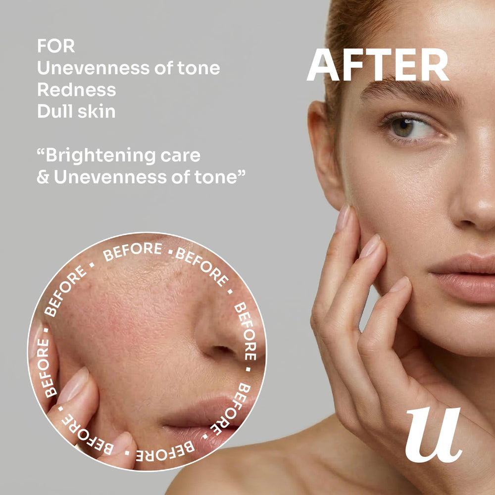 uLOOK ingredients display highlighting niacinamide and azelaic acid benefits