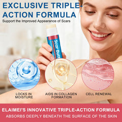 UXENPHXF close-up of creamy scar butter texture demonstrating rich hydration benefit