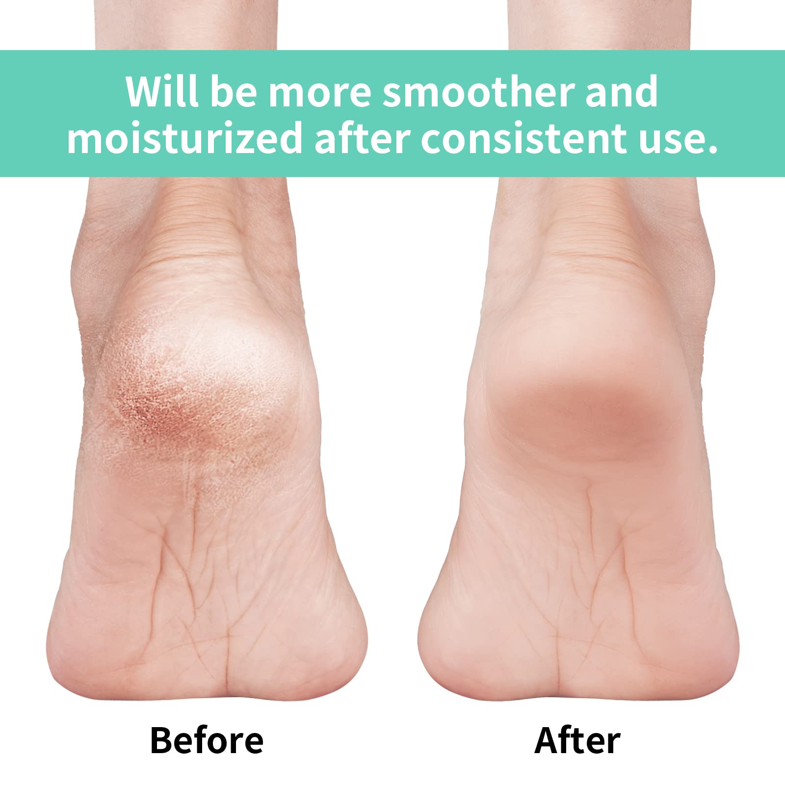 Vaincre close-up of silicone gel pad for targeted heel hydration