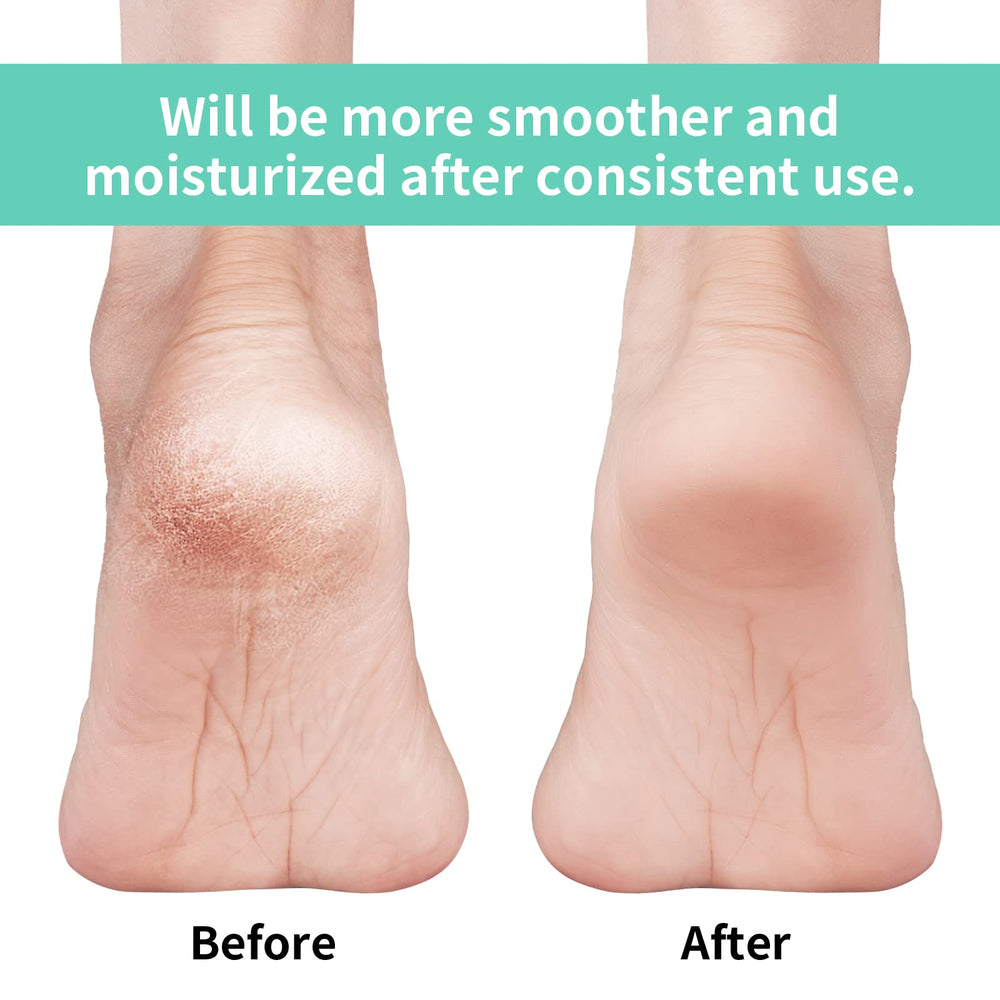 Vaincre close-up of silicone gel pad for targeted heel hydration