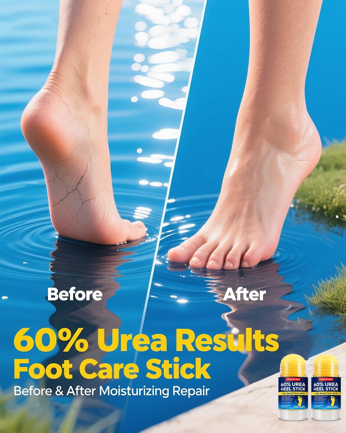 VANUZITARA stick being applied to heel demonstrating targeted callus care