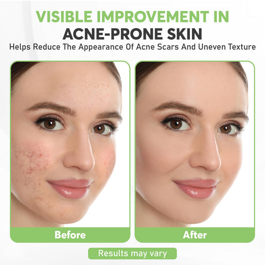Varixoa serum texture drop highlighting lightweight hydration