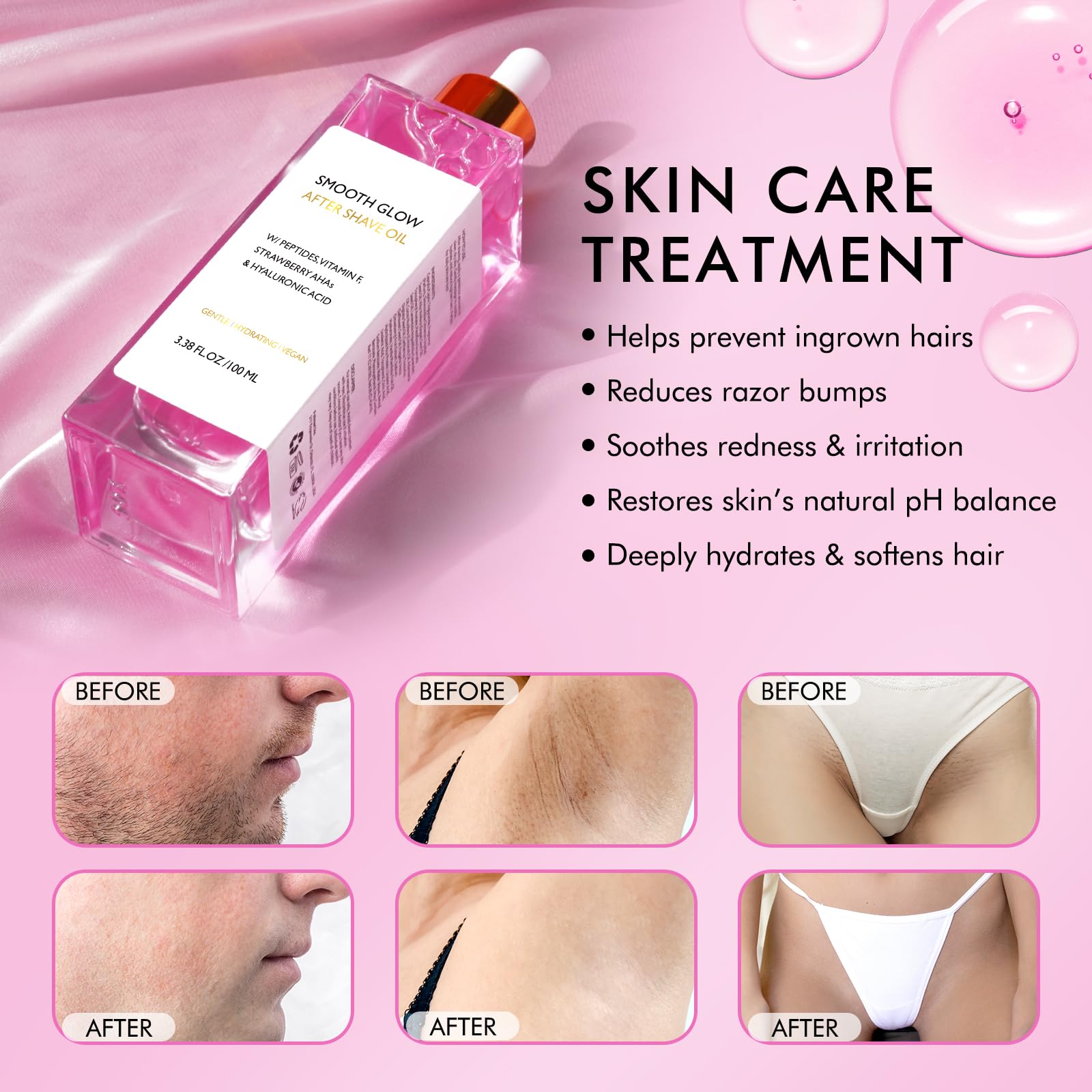 Vceeoy bottle beside strawberries suggesting natural exfoliant benefits
