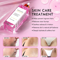 Vceeoy bottle beside strawberries suggesting natural exfoliant benefits