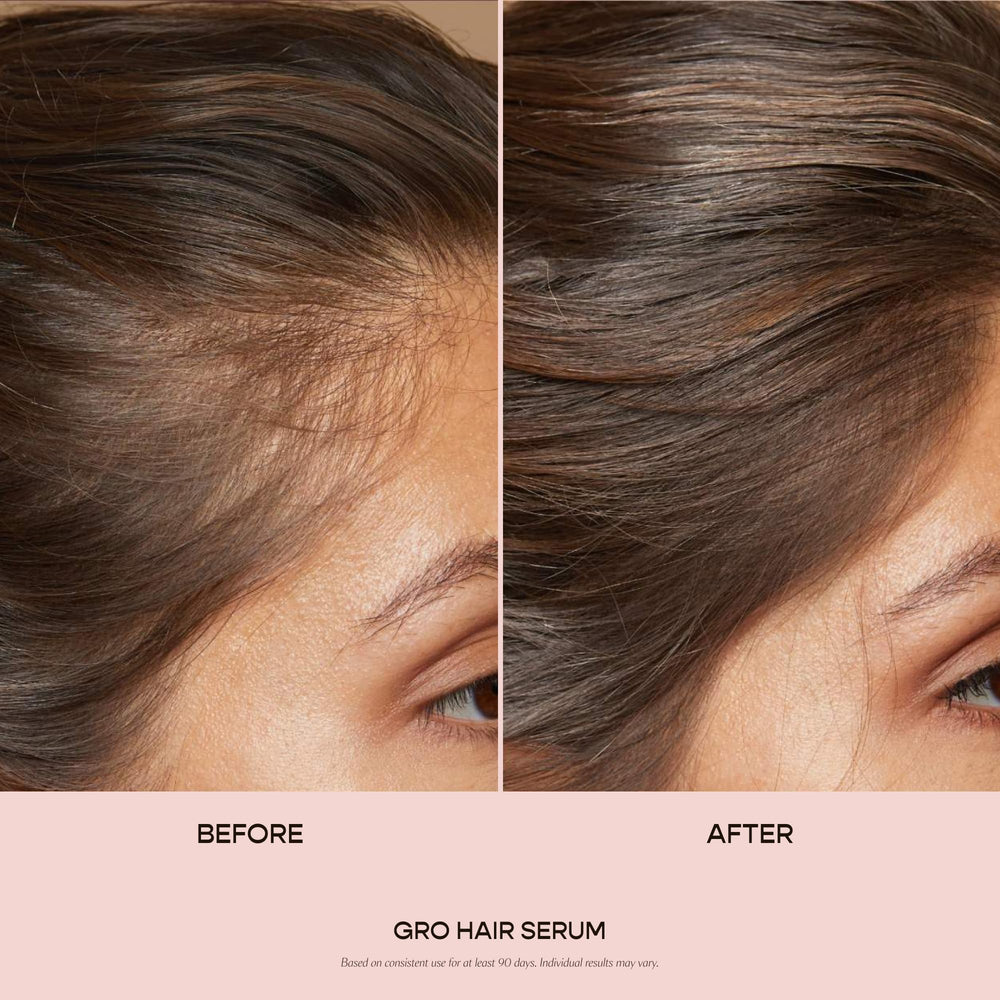 VEGAMOUR dropper dispensing measured daily dose for scalp care