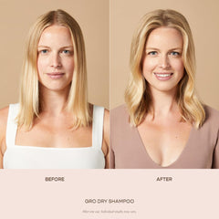 VEGAMOUR before and after showing visible volume and reduced oiliness